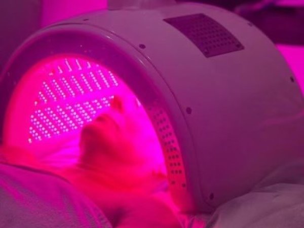 LED Treatment