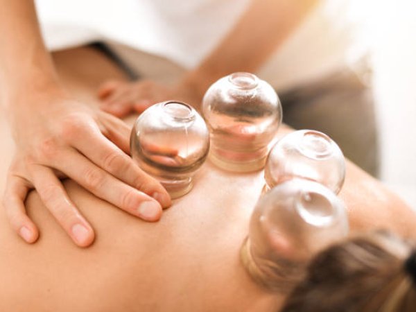 Cupping