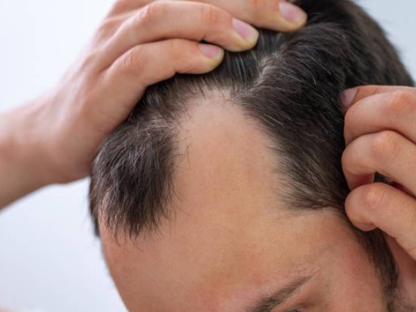 Hair Growth Treatment