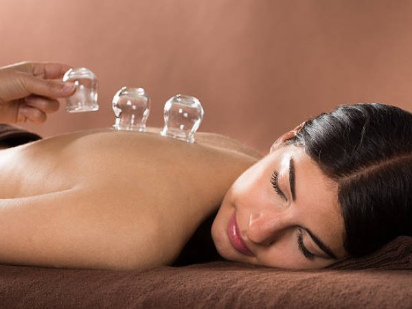 Cupping Therapy